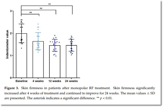 올리지오 유지기간 얼마나 오래가는지 궁금하다면? 관련 이미지 6