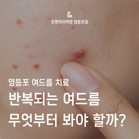 Yeongdeungpo Acne Treatment: What Should You Look at First When Acne Keeps Coming Back? image 1