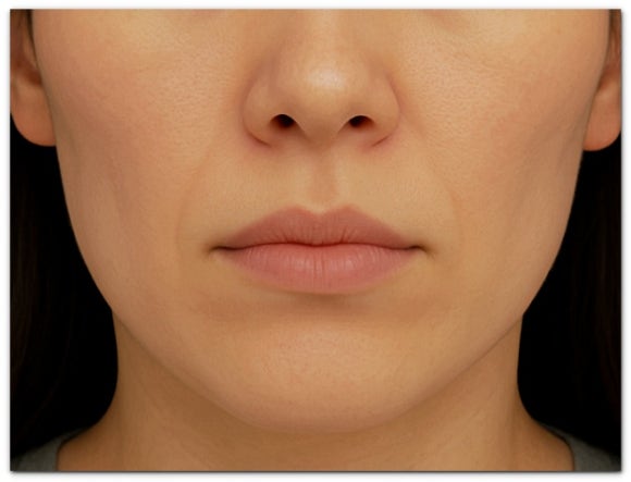 울쎄라 온다 리프팅 차이 비교, 같이 받으면 어떨까? 관련 이미지 9