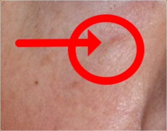 영등포 쥬베룩, 실패 없이 받으려면? 관련 이미지 5