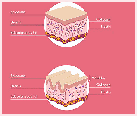 Why the Duration of Juvelook Results Varies from Person to Person at Mullae Dermatology Clinic image 4