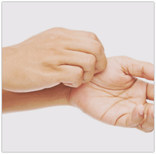 영등포사마귀, 피부 전염되는 이유와 관리 방법은? 관련 이미지 5