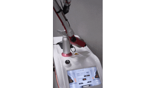 영등포루비레이저 주근깨 잡티 어디까지 효과 있을까? 관련 이미지 9