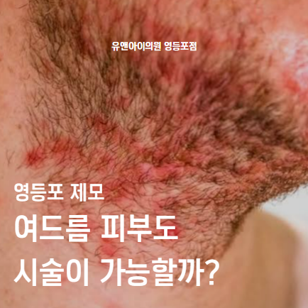 영등포 제모, 여드름 피부도 시술이 가능할까? 관련 이미지 1