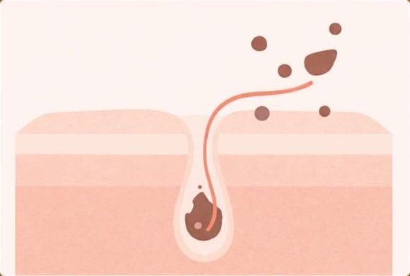 영등포피부과추천 후기 찾는 분들이 놓치기 쉬운 기준 관련 이미지 6