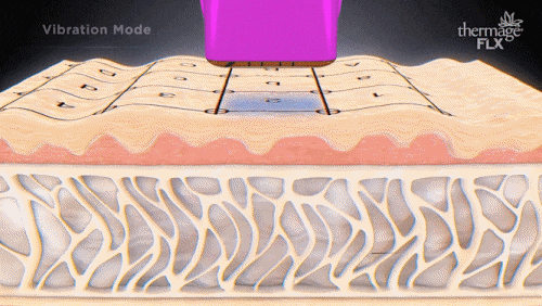 영등포피부과추천 써마지 리쥬란 같이 받으면 효과 길어질까? 관련 이미지 4