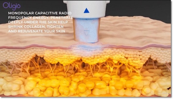 올리지오 유지기간 얼마나 오래가는지 궁금하다면? 관련 이미지 2