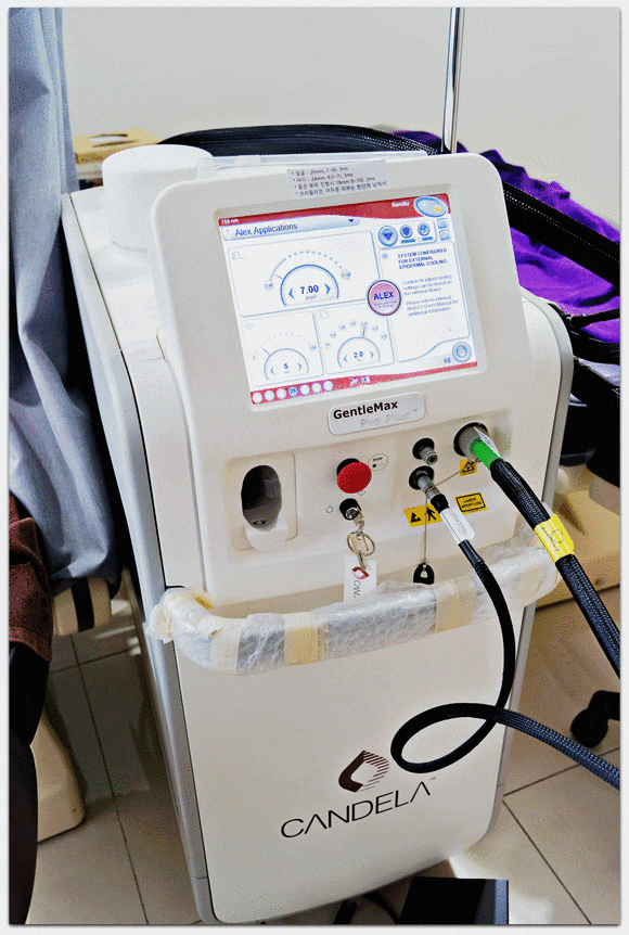 영등포제모, 왜 젠틀맥스 프로플러스 추천이 많을까? 관련 이미지 4