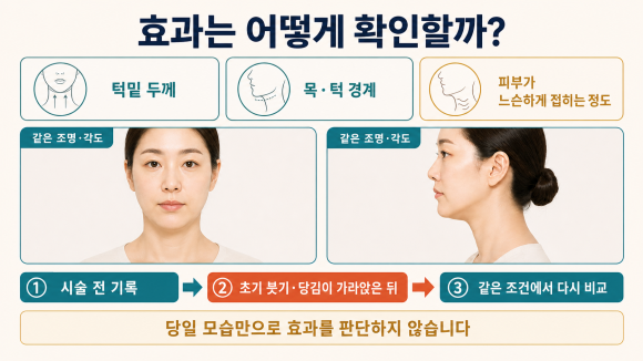 영등포 온다리프팅 이중턱 정리에 효과를 보려면? 관련 이미지 5