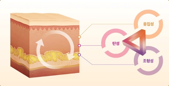 목주름 벨로테로, 깊은 주름에도 효과 있을까? 관련 이미지 2