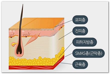 울쎄라 온다 리프팅 차이 비교, 같이 받으면 어떨까? 관련 이미지 8