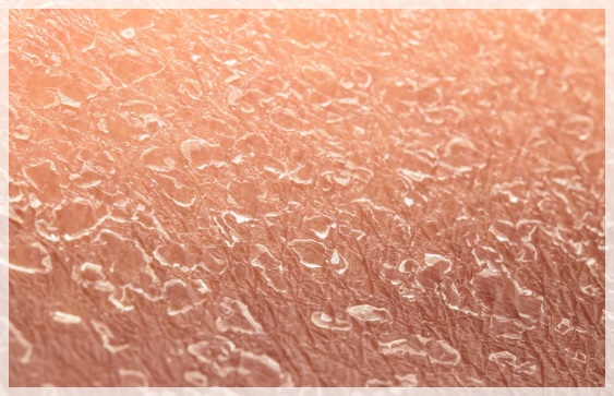 영등포엑소좀 피부 좋아지는 효과는? 관련 이미지 4