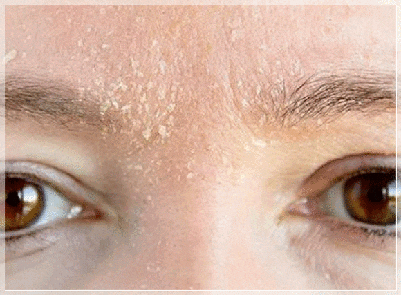 Recommended Dermatology Clinic in Mullae: Wondering Whether You Need Skincare or Treatment? image 5