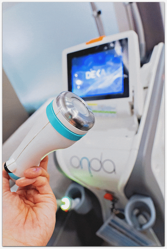 온다리프팅 6만줄 실제 효과, 통증, 부작용은 어떨까? 관련 이미지 8