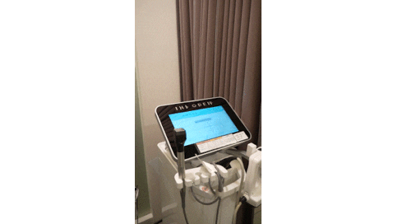 인모드 슈링크 효과 기간 비교해드립니다. 관련 이미지 5