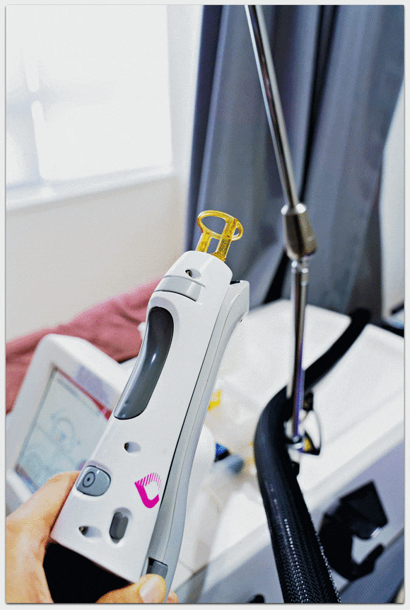 영등포제모, 왜 젠틀맥스 프로플러스 추천이 많을까? 관련 이미지 5