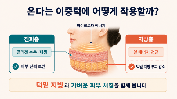 영등포 온다리프팅 이중턱 정리에 효과를 보려면? 관련 이미지 3