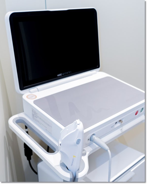 온다리프팅 이중턱 정리 효과, 어느 정도일까? 관련 이미지 5