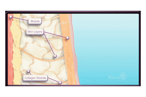울써마지 효과시기와 유지기간은 어느 정도일까? 관련 이미지 7