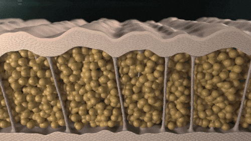 영등포피부과리프팅 통증 적고 효과도 좋은 리프팅이 필요하다면? 관련 이미지 6