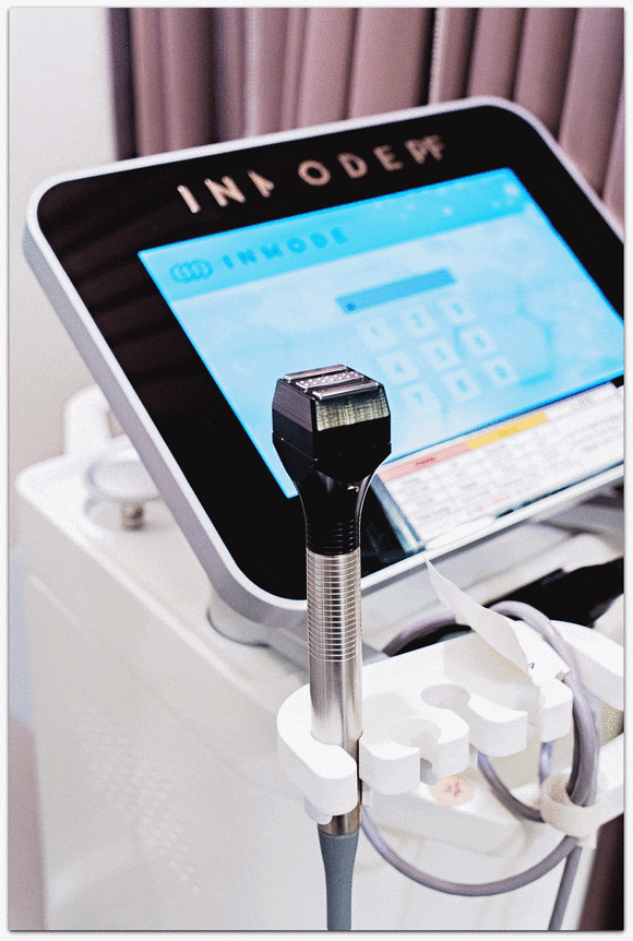 인모드 슈링크 주기, 어떻게 맞추면 좋을까? 관련 이미지 1