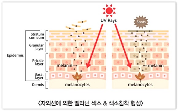 영등포점제거 깔끔하게 점빼기 가능할까? <재발 관련 내용 포함> 관련 이미지 2