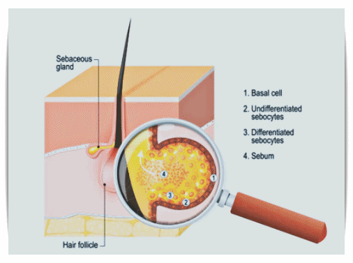 영등포여드름관리 압출해도 재발한다면? 관련 이미지 2