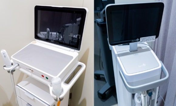 울쎄라피 써마지 차이 효과 비교 관련 이미지 1