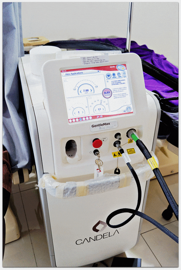 영등포제모, 왜 젠틀맥스 프로플러스 추천이 많을까? 관련 이미지 1