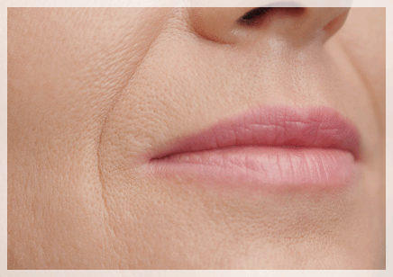 Recommended Dermatology Clinic in Yeongdeungpo: What to Check Before Getting Fillers image 5