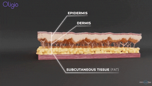 올리지오X 올리지오 개선사항 <300샷 효과> 관련 이미지 6