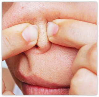 영등포여드름치료, 시술로 효과 보려면? 관련 이미지 7