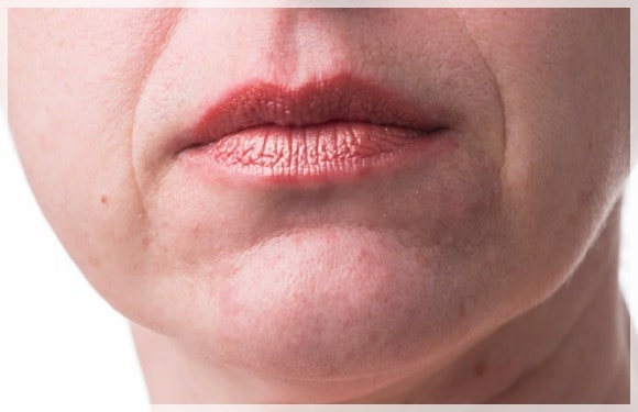 영등포 리쥬란 힐러 피부 재생 효과 보려면? 관련 이미지 6