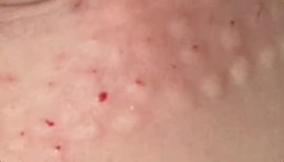 영등포 리쥬베룩 뜻 효과 후기 궁금하다면? 관련 이미지 5