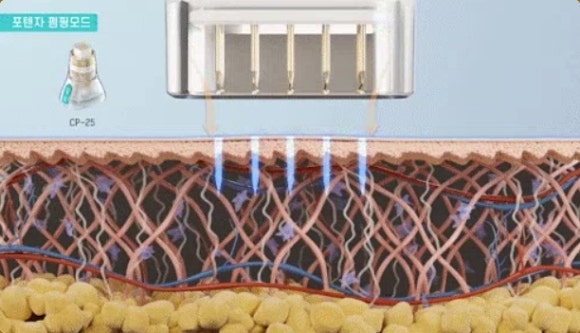 리쥬란 쥬베룩 포텐자 조합 궁금하다면? 관련 이미지 2