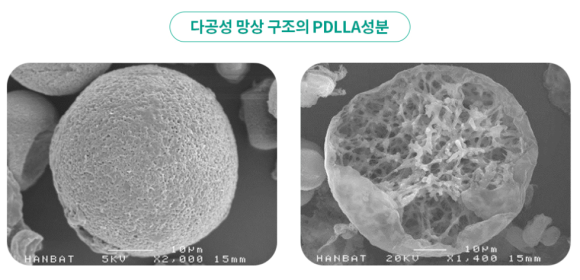 What Do You Think of the Combination of Jambersil and Juvelook for Nasolabial Folds? image 5