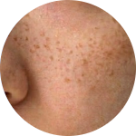 What Makes the Face Look Dull image 5