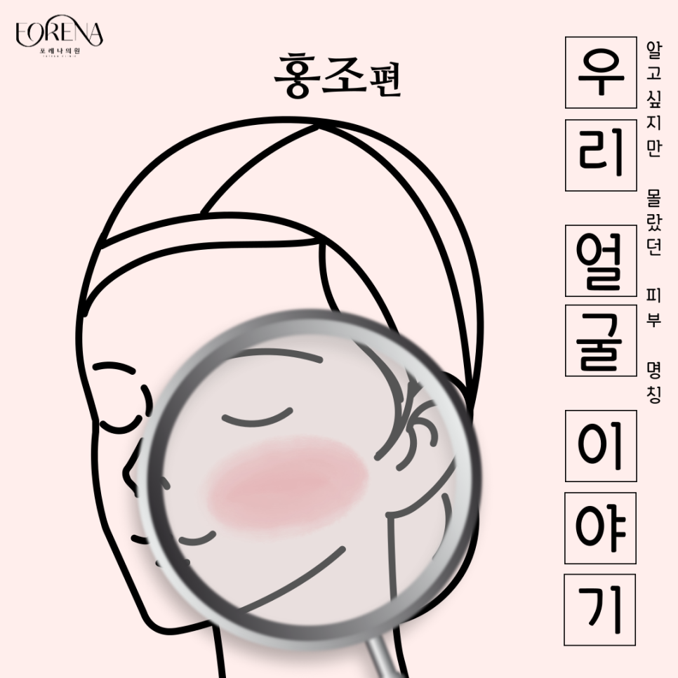 홍조에 대해 하나부터 열까지 알아보자! 👀 관련 이미지 2