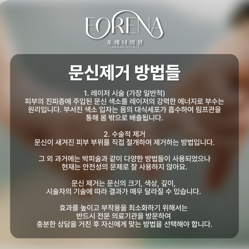 어렸을 때 한 문신 이제는 지우고 싶다면..? 관련 이미지 4