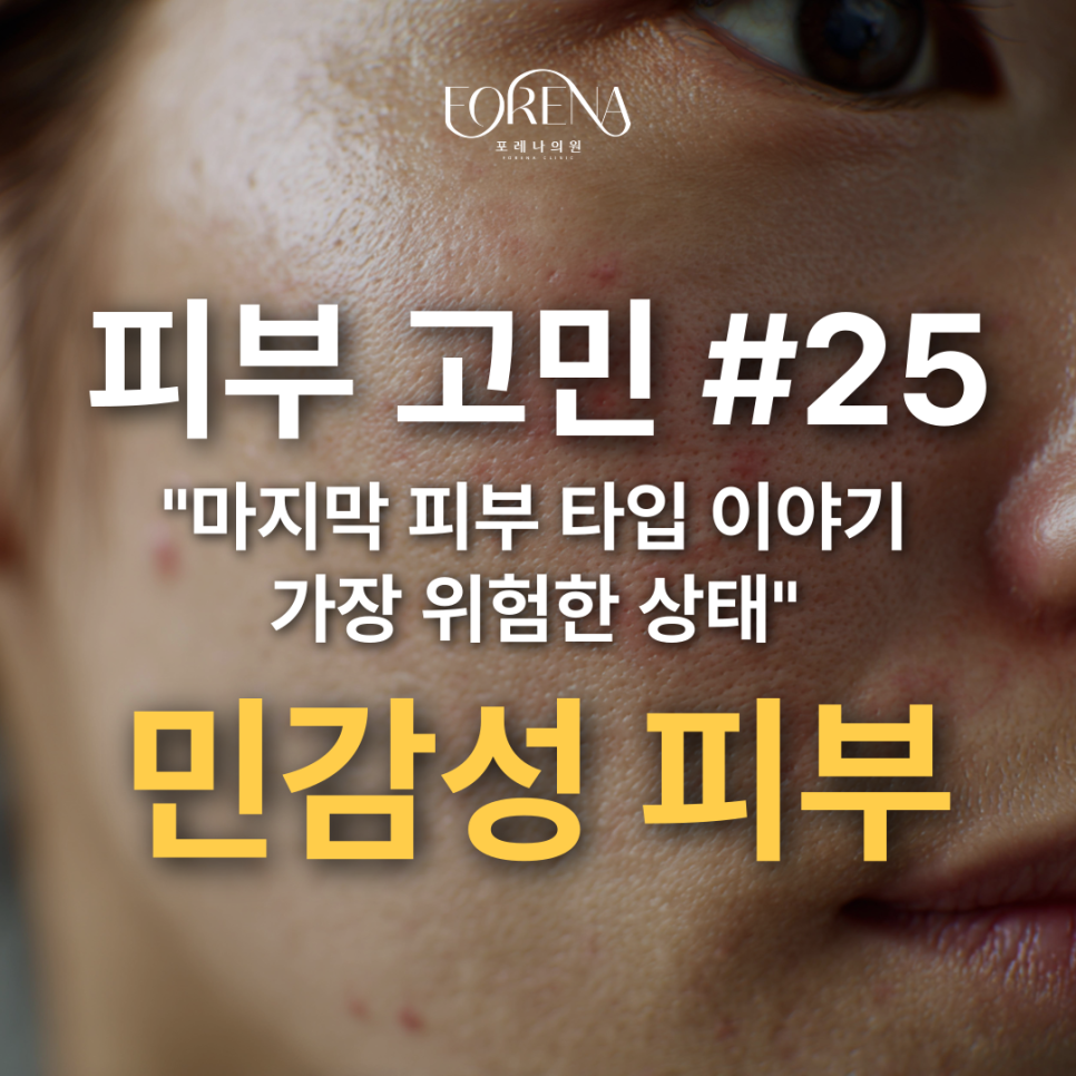 피부 타입 끝판왕 포지션 민감성 피부를 알아보자..! 🥹 관련 이미지 2