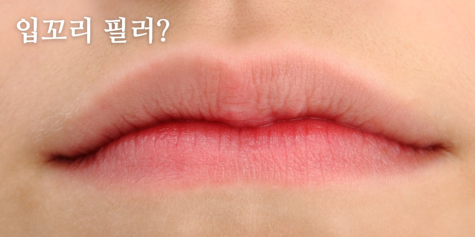 무표정인데 화나보이는 처진 입꼬리 컴플렉스? 🥹  홍대 포레나의원 영상으로 같이보자! 관련 이미지 4