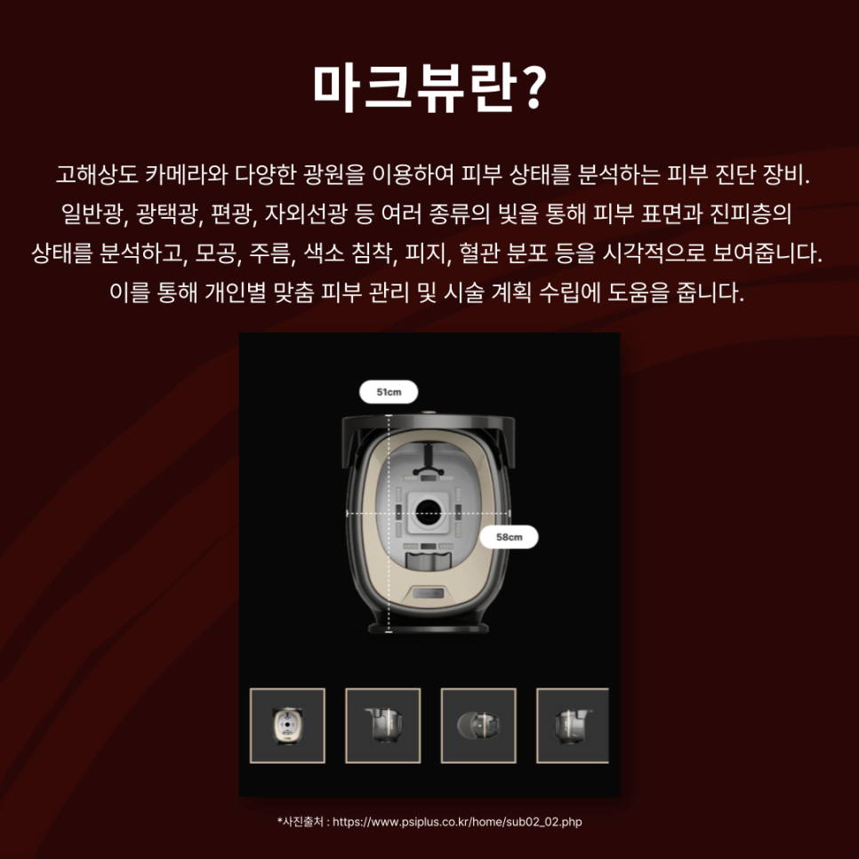 피부과의 기본! 마크뷰를 알아보자 🔎 관련 이미지 4
