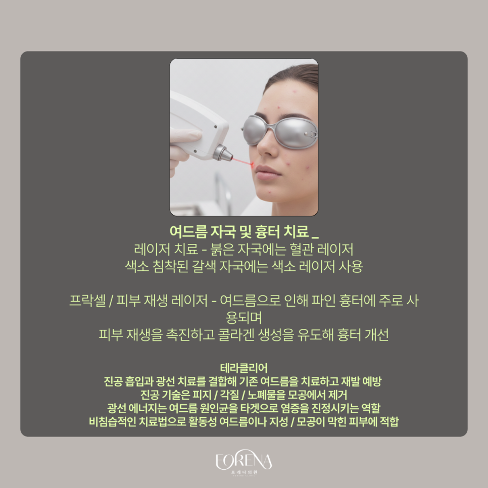 여드름 잘 생기는 부위는 따로 있다? 관련 이미지 7