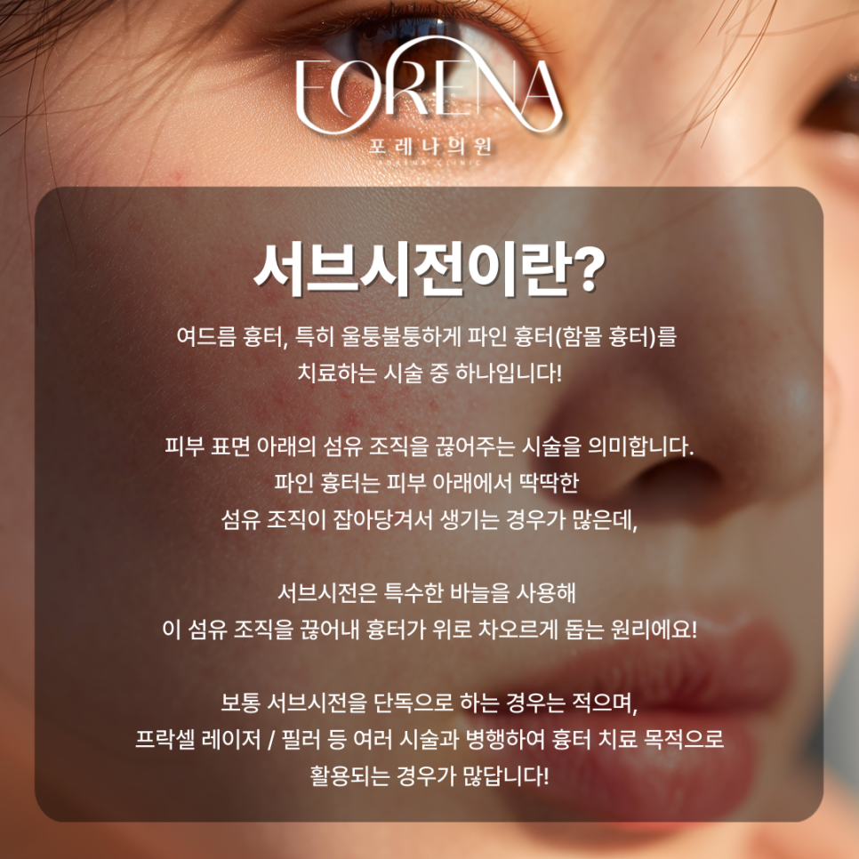 피부과 서브시전 고민중일 때 보기 좋은 주의사항 관련 이미지 3