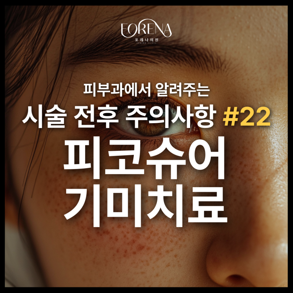 기미치료를 피코슈어 레이저치료로 결정했다면 보기 좋은 주의사항🚨 관련 이미지 2