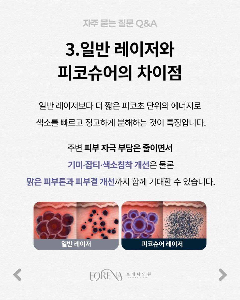 피코슈어Q&A | 시술 원리와 특징 정리 관련 이미지 4