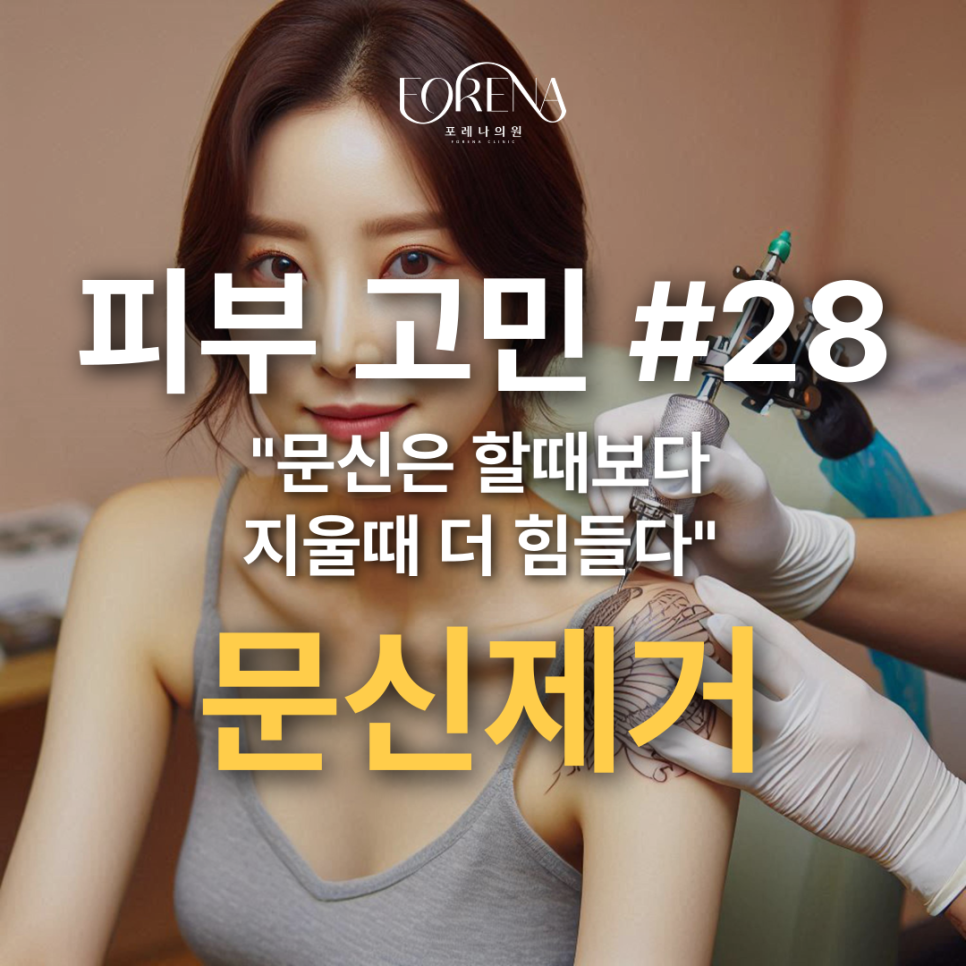 어렸을 때 한 문신 이제는 지우고 싶다면..? 관련 이미지 2