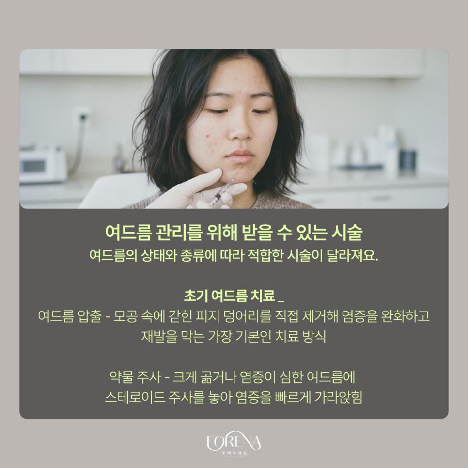 여드름 잘 생기는 부위는 따로 있다? 관련 이미지 6