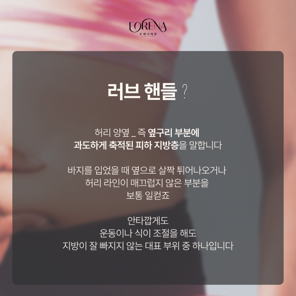 피부과에서 알려주는 러브 핸들과 이별하는 방법 관련 이미지 3