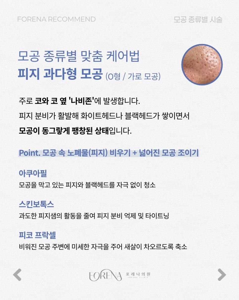 모공 유형별 관련 이미지 3